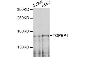 Western blot analysis of extracts of various cell lines, using TOPBP1 antibody. (TOPBP1 Antikörper)