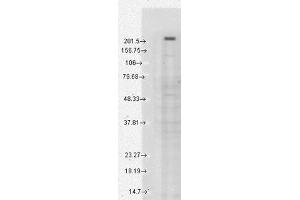 TRPM7 Western Blot. (TRPM7 Antikörper  (C-Term))