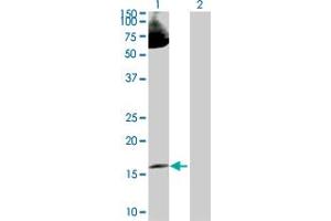 Western Blot analysis of LMO2 expression in transfected 293T cell line by LMO2 MaxPab polyclonal antibody. (LMO2 Antikörper  (AA 1-158))