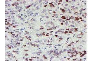 Image no. 1 for anti-Myeloid Leukemia Factor 1 (MLF1) antibody (ABIN1499495) (MLF1 Antikörper)