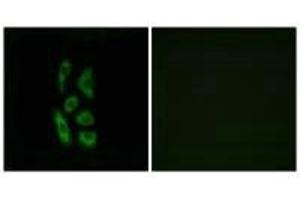 Immunofluorescence analysis of A549 cells, using ACOT12 antibody. (ACOT12 Antikörper)