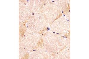 Immunohistochemistry (Paraffin-embedded Sections) (IHC (p)) image for anti-Integrin, alpha 7 (ITGA7) (AA 247-279), (N-Term) antibody (ABIN6243592)