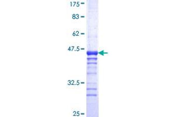 Presenilin 2 Protein (AA 1-86) (GST tag)