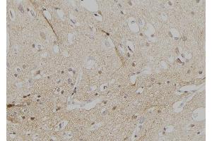 ABIN6257183 and ABIN6274545 at 1/100 staining Human brain tissue by IHC-P.