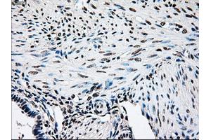 Immunohistochemical staining of paraffin-embedded pancreas tissue using anti-BRAFmouse monoclonal antibody. (BRAF Antikörper)