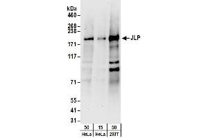 Western Blotting (WB) image for anti-Sperm Associated Antigen 9 (SPAG9) (AA 775-825) antibody (ABIN7454612) (SPAG9 Antikörper  (AA 775-825))
