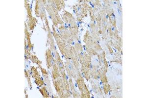 Immunohistochemistry of paraffin-embedded rat heart using CCM2 antibody. (CCM2 Antikörper  (AA 1-300))