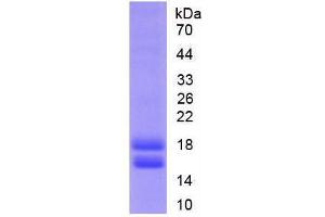 Image no. 1 for Cytochrome P450, Family 1, Subfamily B, Polypeptide 1 (CYP1B1) (AA 374-516) (Active) protein (His tag) (ABIN6239886)