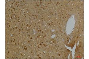 Immunohistochemistry (IHC) analysis of paraffin-embedded Rat Brain Tissue using Kv10. (KCNH5 Antikörper)