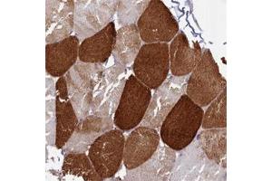 Immunohistochemical staining of human skeletal muscle with ANKRD2 polyclonal antibody  shows strong cytoplasmic positivity in myocytes at 1:500-1:1000 dilution. (ANKRD2 Antikörper)
