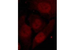 Immunofluorescence staining of methanol-fixed Hela cells showing nuclear staining using HDAC2(Phospho-Ser394) Antibody.