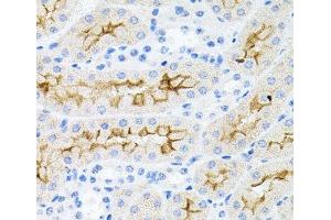 Immunohistochemistry of paraffin-embedded Mouse kidney using IL17A Polyclonal Antibody at dilution of 1:100 (40x lens). (Interleukin 17a Antikörper)