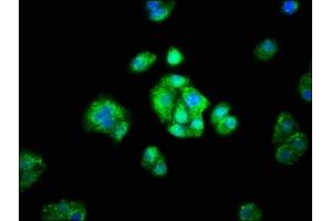 Immunofluorescence staining of HepG2 cells with ABIN7143641 at 1:66, counter-stained with DAPI. (ADH1A Antikörper  (AA 104-253))