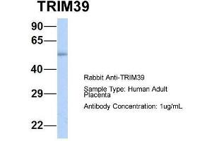 TRIM39 anticorps  (Middle Region)