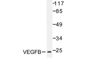 Image no. 1 for anti-Vascular Endothelial Growth Factor B (VEGFB) antibody (ABIN271976) (VEGFB Antikörper)