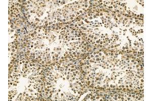 CAMKK1 Mouse Monoclonal Antibody at 1/100 staining mouse testis tissue by IHC-P. (CAMKK1 Antikörper  (C-Term))