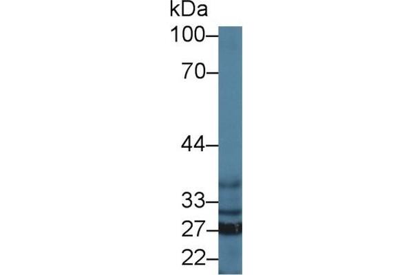 SFXN1 Antikörper  (AA 2-102)