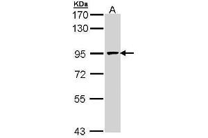 WB Image Sample (30 ug of whole cell lysate) A: H1299 7. (MCM7 Antikörper)