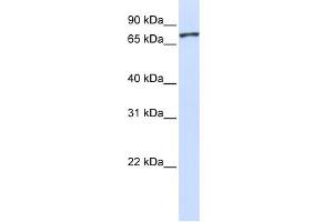 WB Suggested Anti-UNC5A Antibody Titration:  0. (UNC5A Antikörper  (Middle Region))