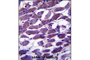 MYOM1 Antibody (Center) (ABIN657367 and ABIN2846414) immunohistochemistry analysis in formalin fixed and paraffin embedded human skeletal muscle followed by peroxidase conjugation of the secondary antibody and DAB staining.