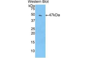 Western blot analysis of the recombinant protein. (TIMP4 Antikörper  (AA 10-170))
