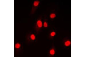 Immunofluorescent analysis of NF-kappaB p100 (pS865) staining in HepG2 cells. (NFKB2 Antikörper  (C-Term, pSer865))