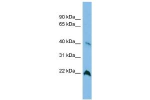 WB Suggested Anti-TGDS Antibody Titration: 0. (TGDS Antikörper  (Middle Region))