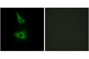 Immunofluorescence analysis of HeLa cells, using CDH17 Antibody. (LI Cadherin Antikörper  (AA 341-390))