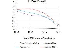 Black line: Control Antigen (100 ng),Purple line: Antigen (10 ng), Blue line: Antigen (50 ng), Red line:Antigen (100 ng) (TET2 Antikörper)