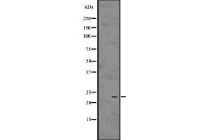 Western blot analysis of Rab9 using 293 whole cell lysates (RAB9A Antikörper  (Internal Region))