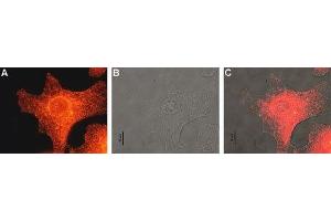 Expression of MC1R in human Malme-3M cells - Immunocytochemical staining of human paraformaldehyde fixed and permeabilized malignant melanoma cell lines (Malme-3M). (MC1 Receptor Antikörper  (AA 217-232))