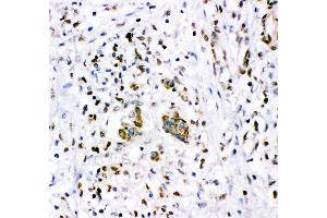 Anti- NR3C1 antibody,IHC(P) IHC(P): Human Mammary Cancer Tissue