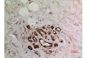 Immunohistochemistry (IHC) analysis of paraffin-embedded Human Breast, antibody was diluted at 1:100. (XRCC6 Antikörper  (acLys539))