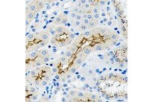Immunohistochemical analysis of TGF beta 2 staining in human kidney formalin fixed paraffin embedded tissue section. (TGFB2 Antikörper)