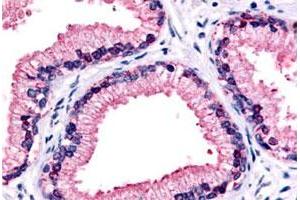 Immunohistochemical (Formalin/PFA-fixed paraffin-embedded sections) staining in human prostate, epithelium with GPR87 polyclonal antibody . (GPR87 Antikörper  (C-Term))