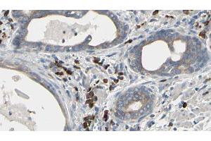 ABIN6277345 at 1/100 staining Human prostate tissue by IHC-P. (USO1 Antikörper  (C-Term))