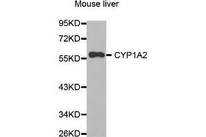 Western Blotting (WB) image for anti-Cytochrome P450, Family 1, Subfamily A, Polypeptide 2 (CYP1A2) (AA 205-305) antibody (ABIN6213604) (CYP1A2 Antikörper  (AA 205-305))