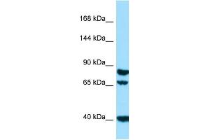 Western Blotting (WB) image for anti-Signal Peptide, CUB Domain, EGF-Like 1 (SCUBE1) (N-Term) antibody (ABIN2790193) (SCUBE1 Antikörper  (N-Term))