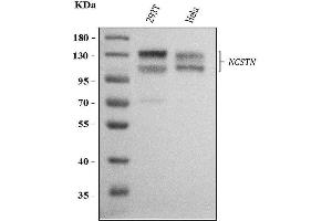 Western blot analysis of NCSTN using anti-NCSTN antibody (ABIN3042580).