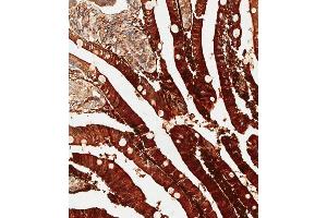 Immunohistochemistry (Paraffin-embedded Sections) (IHC (p)) image for anti-Adenosine Deaminase (ADA) (AA 287-314), (C-Term) antibody (ABIN655597)