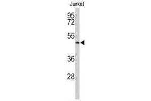 Western blot analysis of ACR Antibody (C-term) in Jurkat cell line lysates (35 µg/lane). (Acrosin Antikörper  (C-Term))