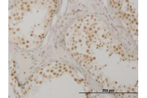 Immunoperoxidase of monoclonal antibody to OXSR1 on formalin-fixed paraffin-embedded human testis. (OXSR1 Antikörper  (AA 351-450))