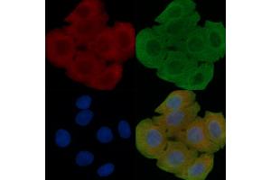 ABIN6260813 and ABIN6277925 staining Hela cells(30 min of UV treatment) by IF/ICC. (Choline Acetyltransferase Antikörper  (C-Term))