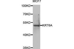 Western blot analysis of extracts of MCF-7 cells, using KRT6A antibody (ABIN5974635) at 1/1000 dilution. (KRT6A Antikörper)