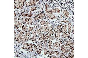 IHC analysis of PTBP1 using anti-PTBP1 antibody (ABIN7599451). (PTBP1 Antikörper  (AA 1-504))