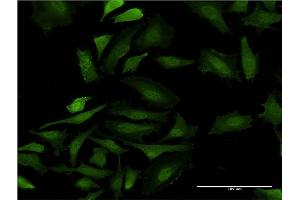 Immunofluorescence of monoclonal antibody to GAGE5 on HeLa cell. (G Antigen 5 Antikörper  (AA 28-117))