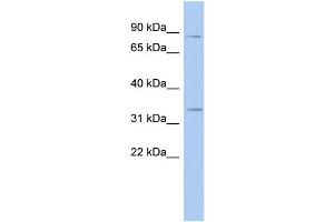 WB Suggested Anti-STX19 Antibody Titration: 0. (Syntaxin 19 Antikörper  (N-Term))