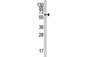 Western blot analysis of CYP26A1 antibody and Jurkat lysate (CYP26A1 Antikörper  (AA 118-147))