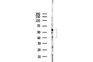 Western blot analysis of lysates from F10-LUC cells(starvation,24h treatment), using ERI1 Antibody at 1/1000 dilution.