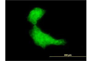 Immunofluorescence of monoclonal antibody to DNAJB2 on A-431 cell.